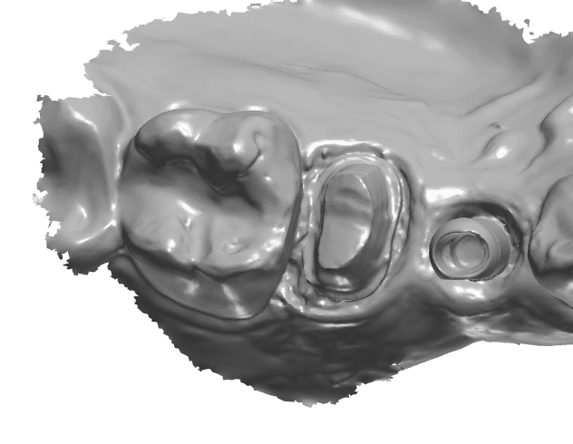 Digital Dentistry - Classic Craft Dental Lab