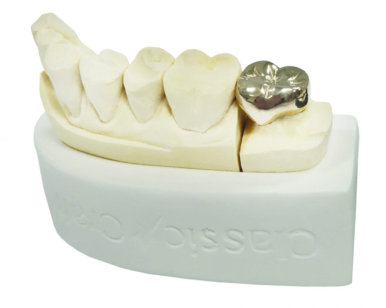 PFZ & PFM Classic Craft Dental Lab