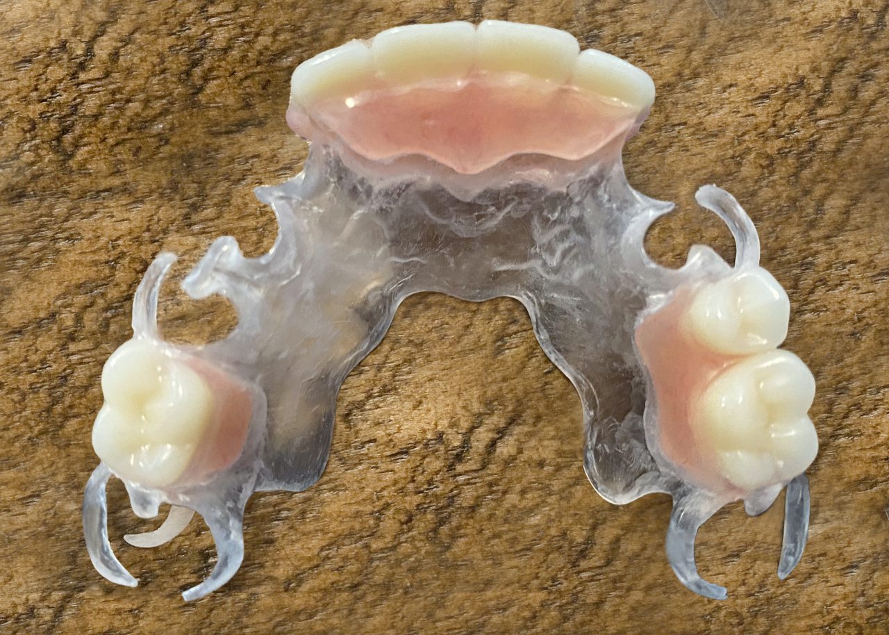 Partials Classic Craft Dental Lab