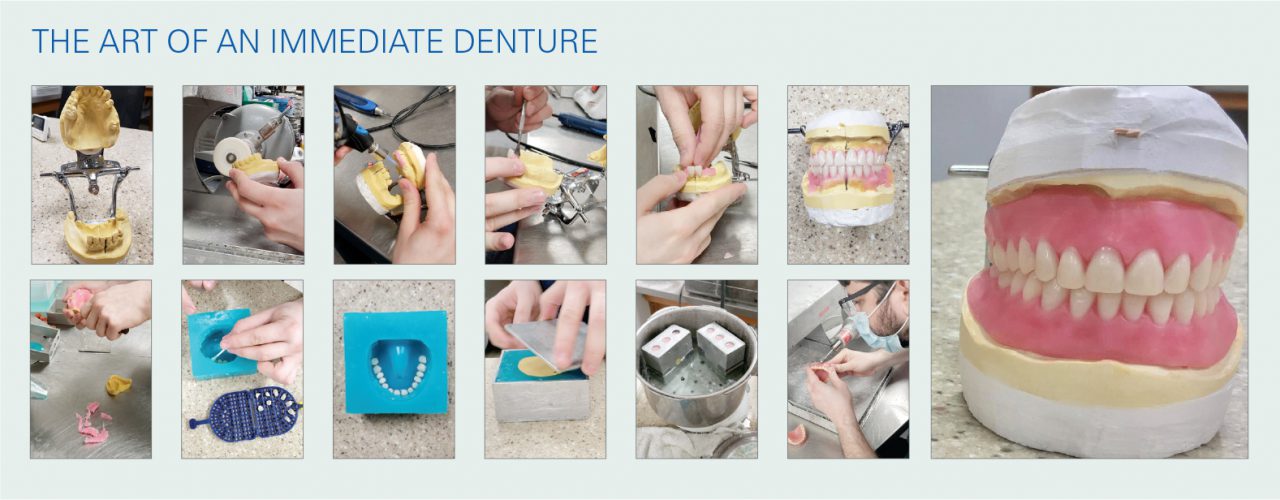 Dentures Classic Craft Dental Lab