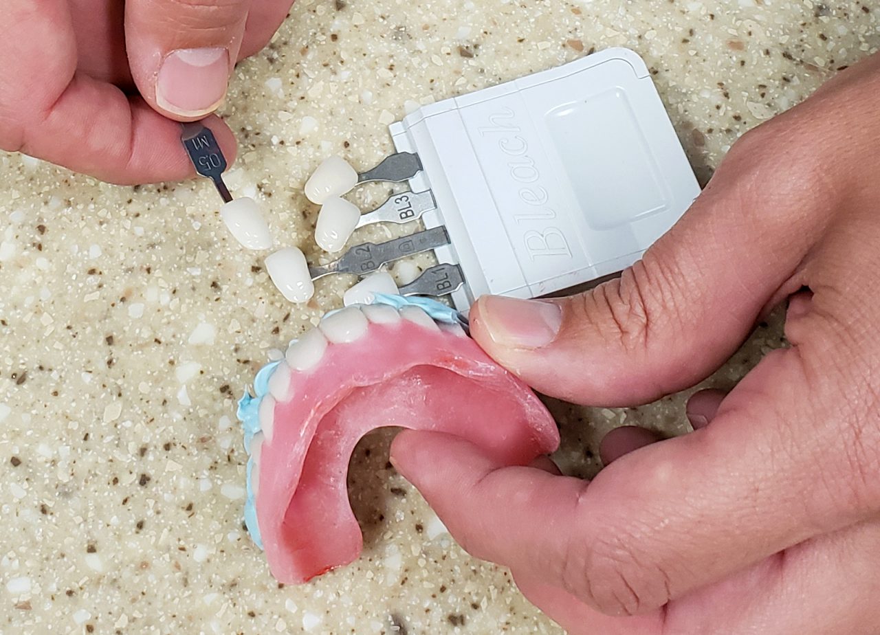 Partials Classic Craft Dental Lab